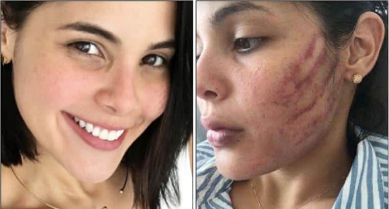 Mujer golpeada brutalmente por su novio