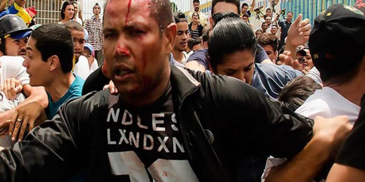 Imagen del teniente Danny José Subero luego de ser golpeado este sábado en Cabudare, Venezuela. Subero murió después.