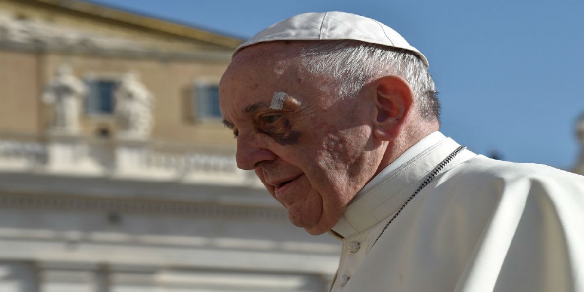 El Papa no se recupera de su ojo tras accidente en Cartagena