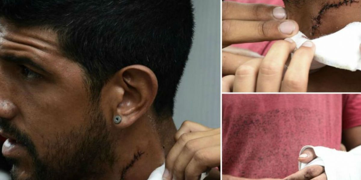 Zona Cero Reiner Hurtado, venezolano herido.