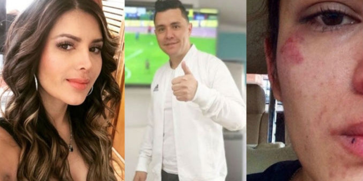 Juliana Daza y su expareja Ricardo Torres.
