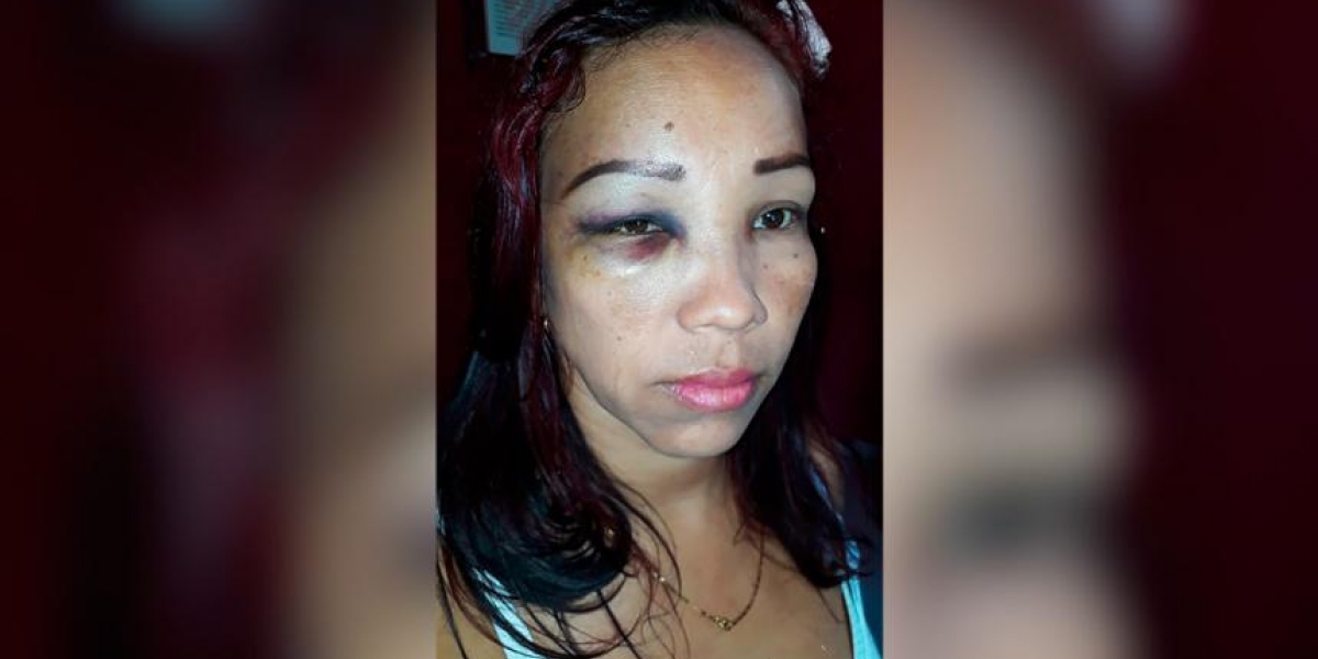 Cindy Aguilera, mujer agredida