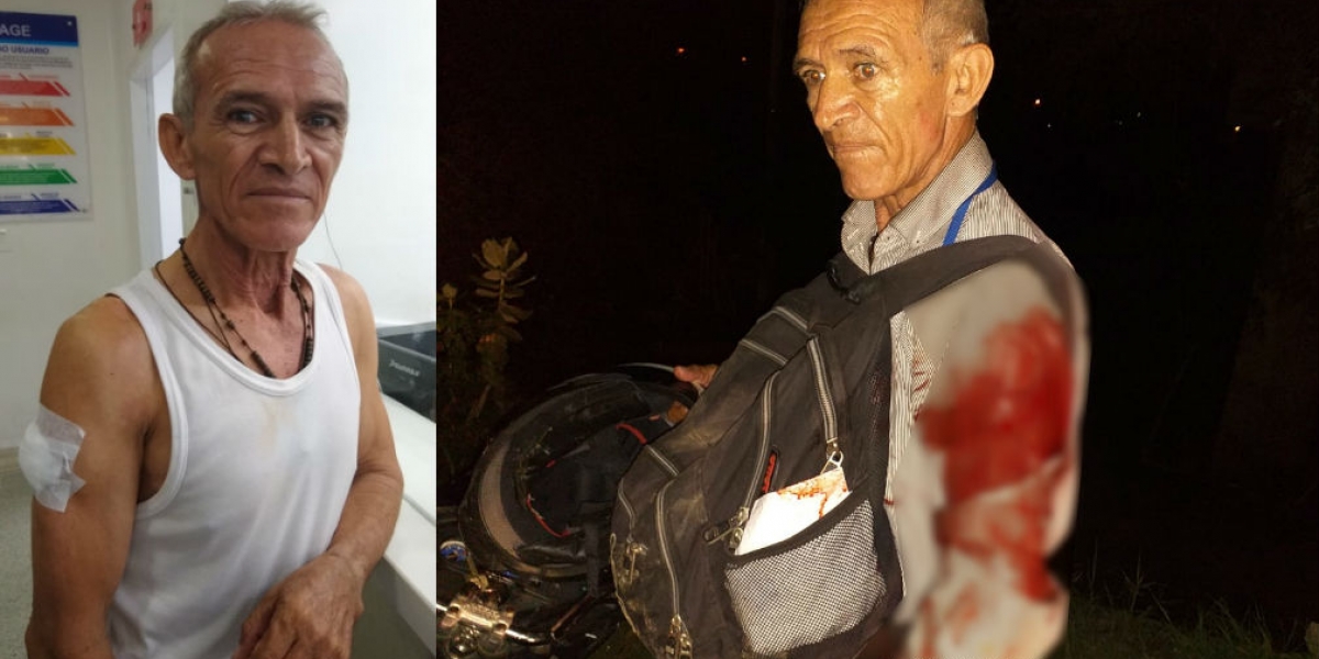 Cortesía Luis Parra, del Hoy Diario del Magdalena, fue atracado por tres personas.