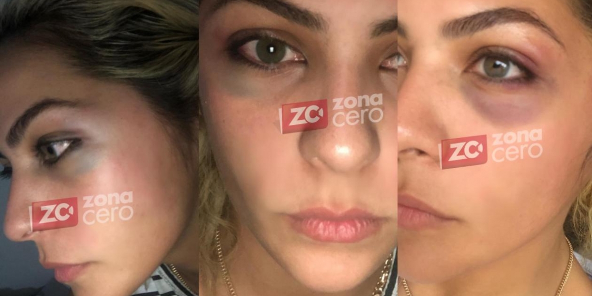 Zona Cero Laura Ojeda