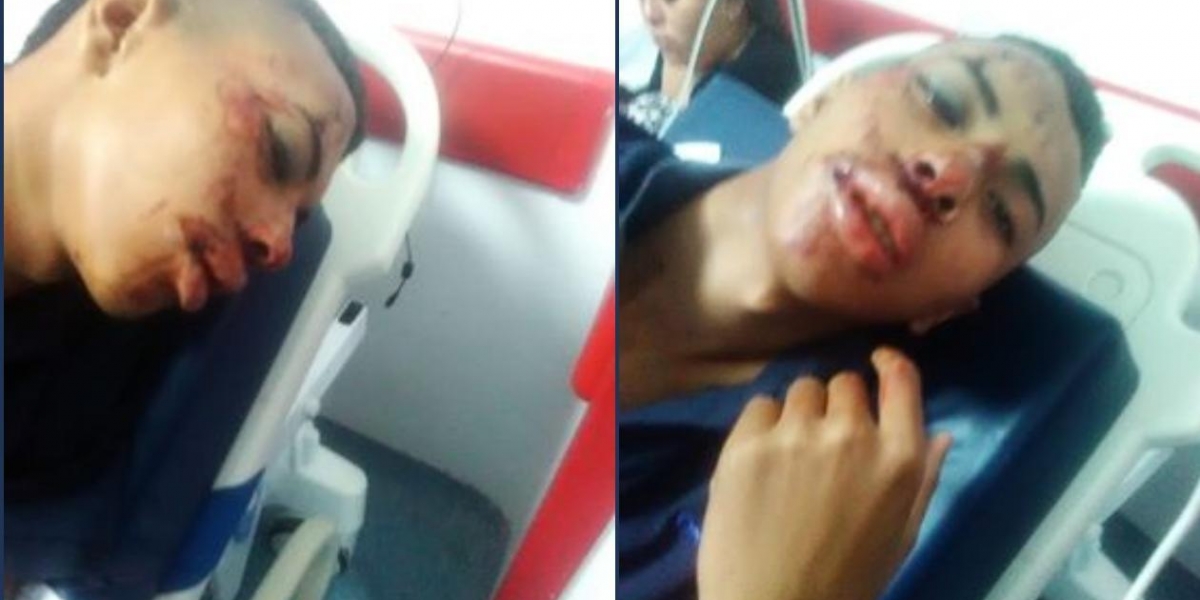 Dayro Andrade Muñoz, hincha de 16 años, agredido por hinchas violentos de Millonarios.