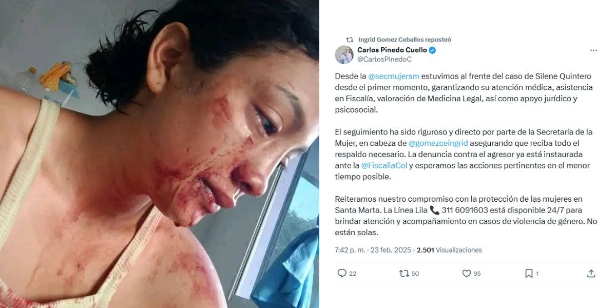 Cortesía Silene Quintero denunció ser víctima de maltrato intrafamiliar.