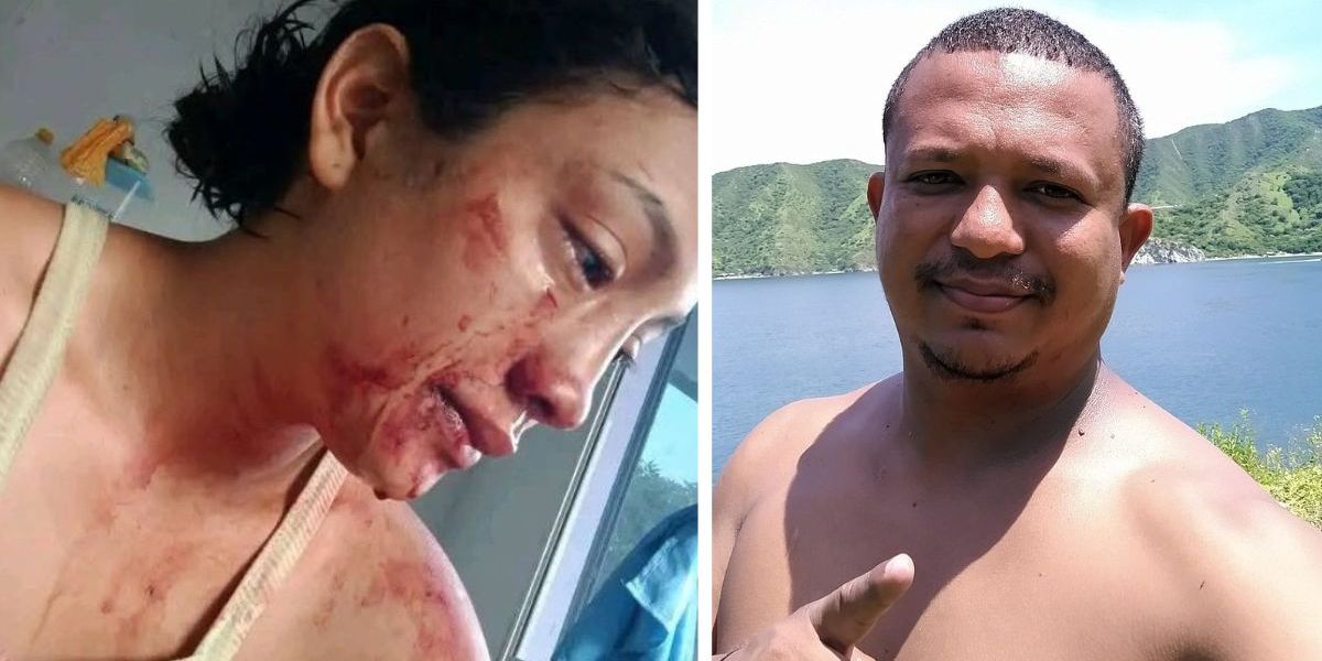 Cortesía Silene Quintero, mujer que denunció ser víctima de violencia intrafamiliar