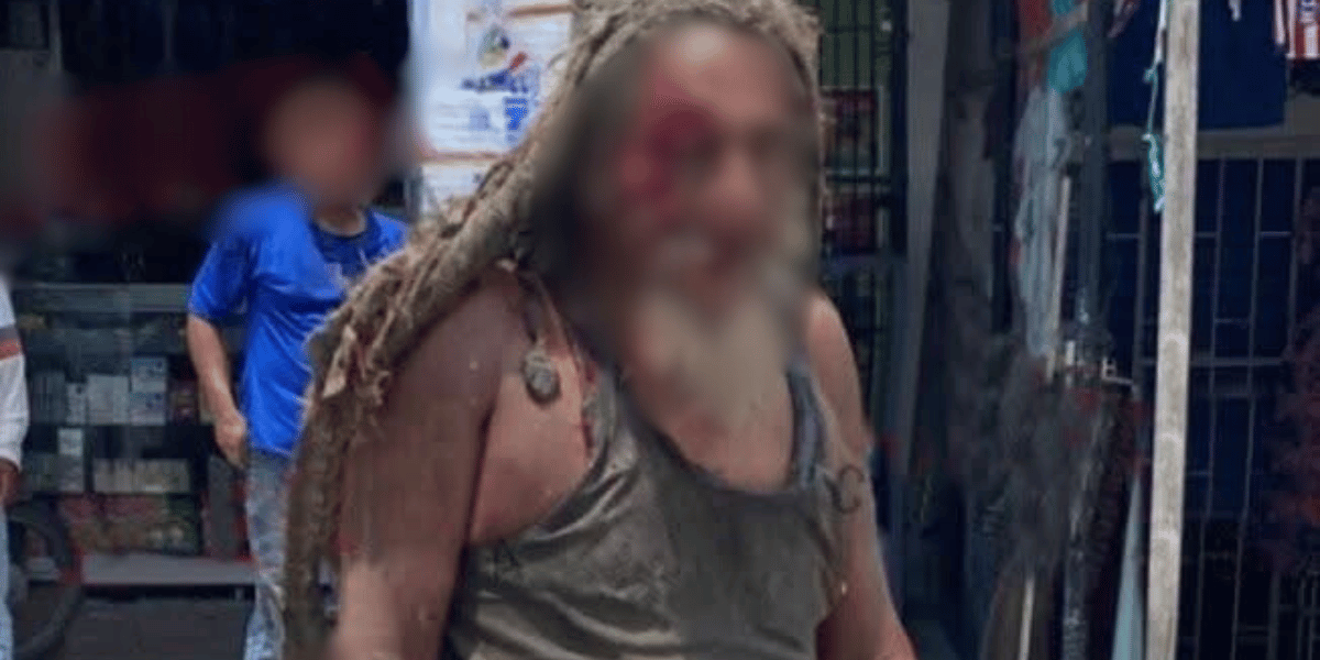 ‘El Purry’, habitante de calle, resultó gravemente herido tras ser atropellado en Ciénaga