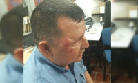 El operario José Osorio fue golpeado. 