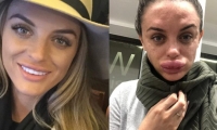 Instagram Rachael Knappier, de 29 años, sufrió graves lesiones en su rostro.