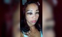 Cindy Aguilera, mujer agredida