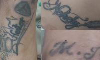 Tatuajes del hombre internado en la clínica Campbell.