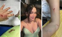 Daniela Gualteros, agredida durante el día de Amor y Amistad