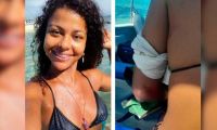 Wendy Pacheco turista venezolana cortada por hélice de un yate.