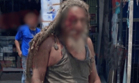 ‘El Purry’, habitante de calle, resultó gravemente herido tras ser atropellado en Ciénaga