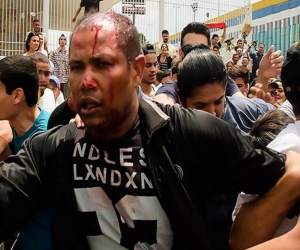 Imagen del teniente Danny José Subero luego de ser golpeado este sábado en Cabudare, Venezuela. Subero murió después.