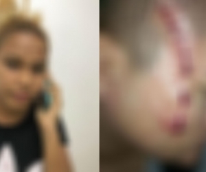 Las imágenes, según el coronel Samir Pava, corresponden a un accidente y no a protestas por cierre de campaña.