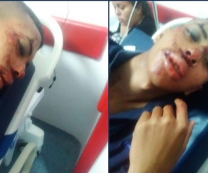  Dayro Andrade Muñoz, hincha de 16 años, agredido por hinchas violentos de Millonarios.