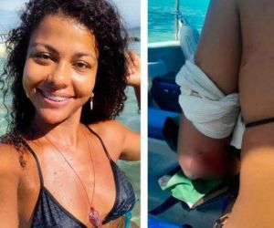 Wendy Pacheco turista venezolana cortada por hélice de un yate.