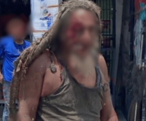 ‘El Purry’, habitante de calle, resultó gravemente herido tras ser atropellado en Ciénaga