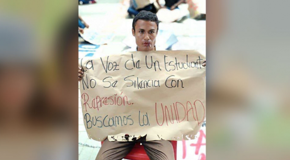 Estudiante se cosió la boca, como forma de protesta.