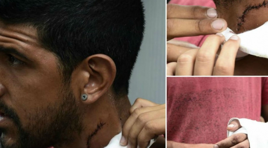 Reiner Hurtado, venezolano herido.
