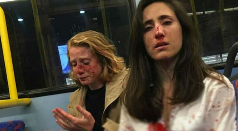 cortesía Paliza recibida por las mujeres en ataque homofóbico.