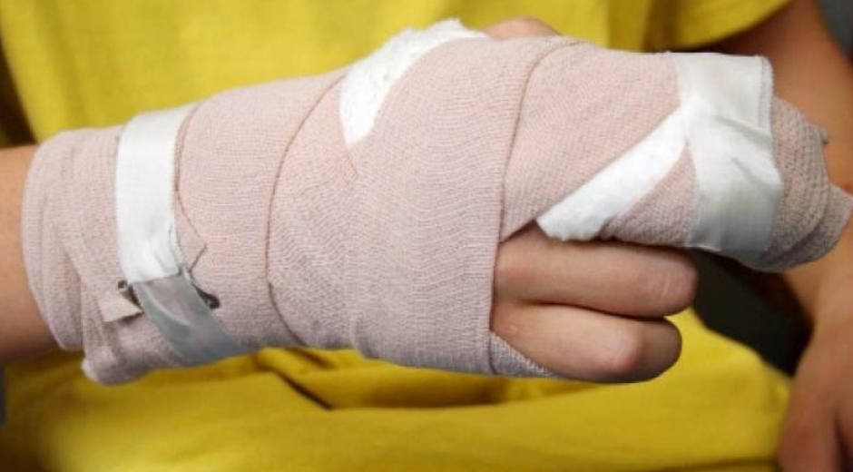 Quemados con pólvoras en el Magdalena