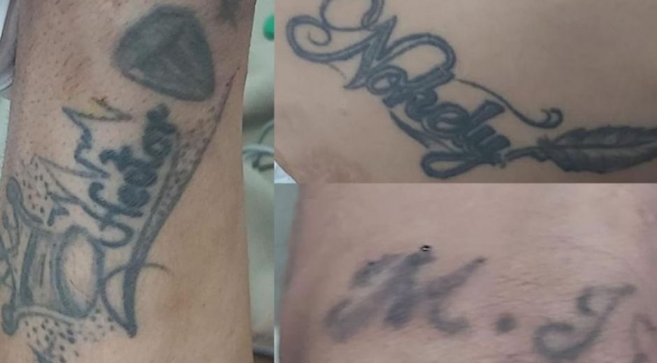Tatuajes del hombre internado en la clínica Campbell.