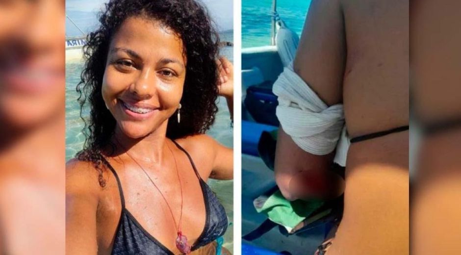 Wendy Pacheco turista venezolana cortada por hélice de un yate.