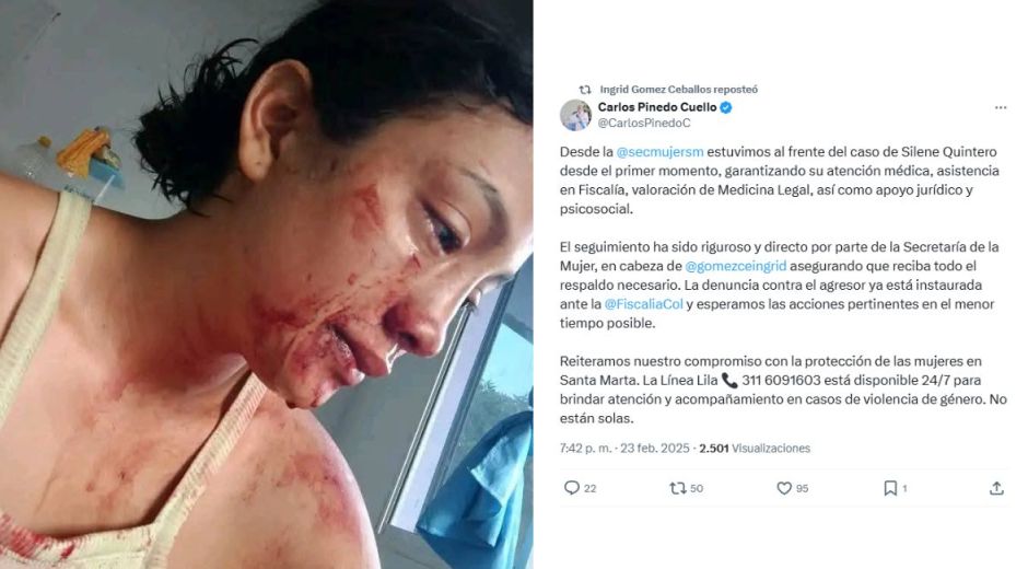 Cortesía Silene Quintero denunció ser víctima de maltrato intrafamiliar.