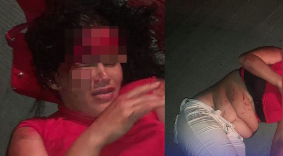 Cortesía Mujer encontrada herida en plena vía rural.