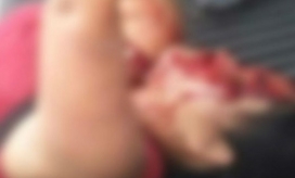 El Callejero Mujer agredida a puñal por su pareja.